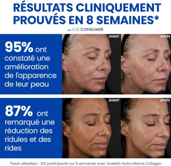 Complément liquide de collagène marin hydrolysé 10 000 mg - 3 x 500 ml (1 500 ml) 60 jours d'approvisionnement - Acide hyaluronique biotine et vitamine C pour des cheveux une peau des Collagène Marin 500ml x 3