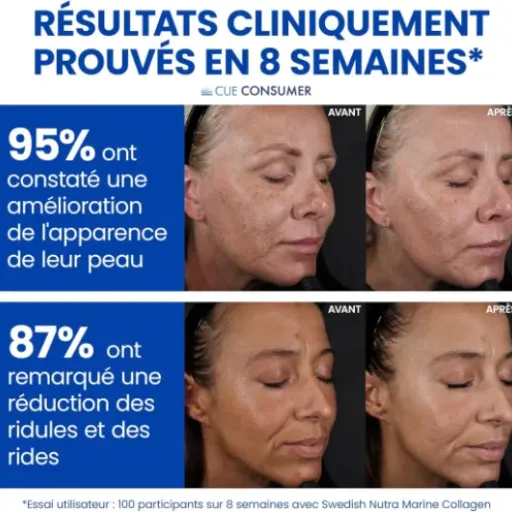 Test Swedish Nutra Collagène Marin 10 000 mg : le shot beauté qui fait (un peu) le job sans être magique